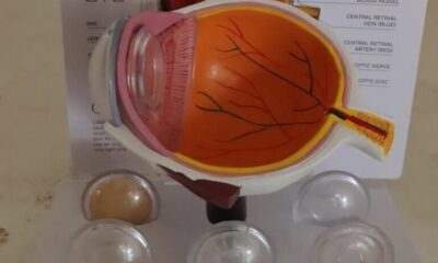 Desarrolla UPT Sistema de Bajo Costo Para Mejorar Imágenes de Retina