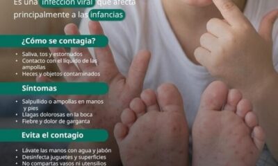 Emite IMSS Hidalgo recomendaciones para prevención de enfermedad causada por virus Coxsackie