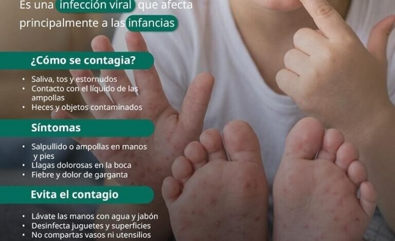 Emite IMSS Hidalgo recomendaciones para prevención de enfermedad causada por virus Coxsackie