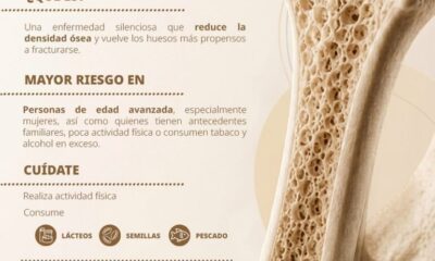 Refuerza IMSS Hidalgo acciones de prevención en Día Mundial de la Osteoporosis