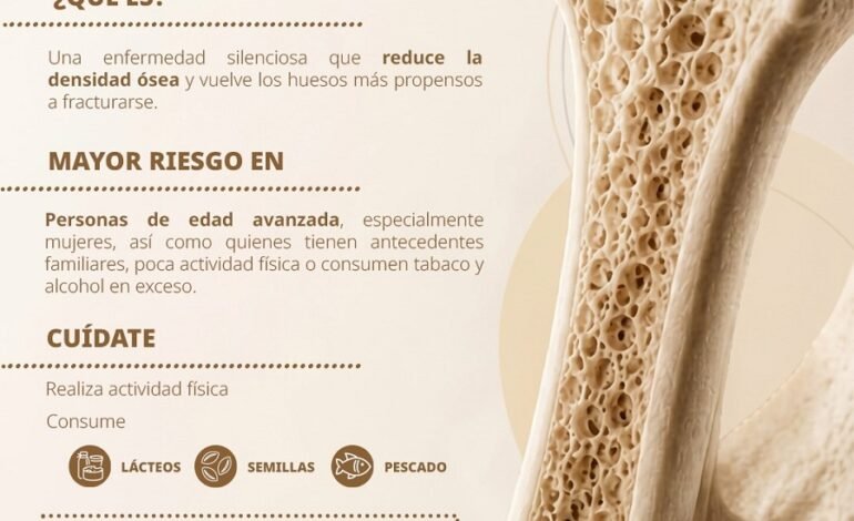 Refuerza IMSS Hidalgo acciones de prevención en Día Mundial de la Osteoporosis